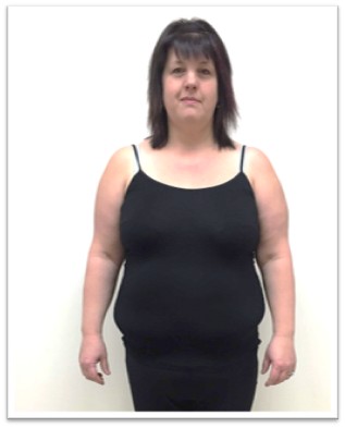 Client before working with Dr. Neveling